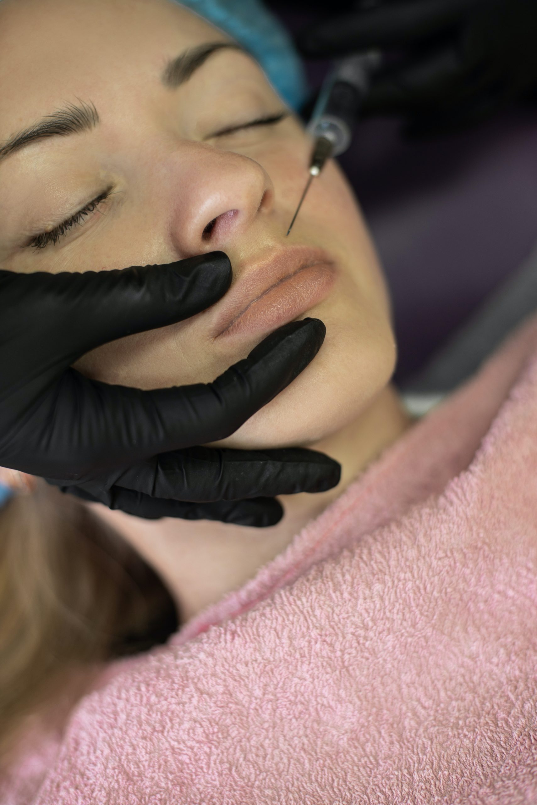 Confira dicas para garantir a segurança na aplicação de botox